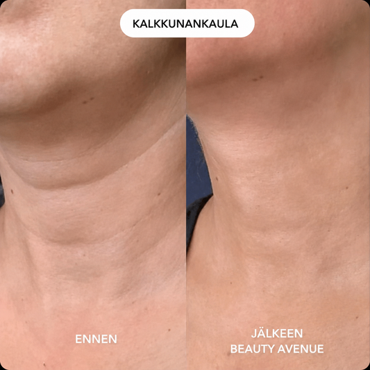 Kollagenhalsmaske for Fastere og Glattere Hud