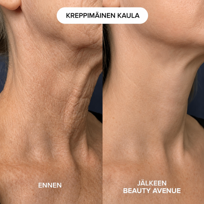 Kollagenhalsmaske for Fastere og Glattere Hud