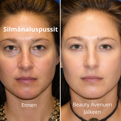 Aloe Vera & Kollagen Øyemasker