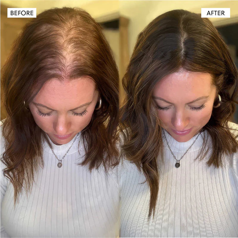 Hair Growth Accelerator