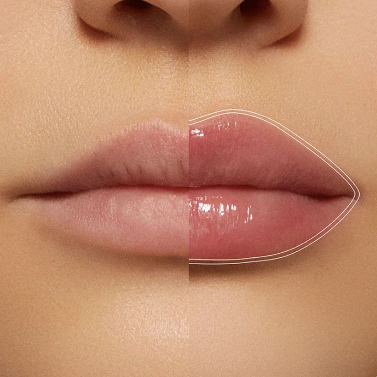 Lip Plumper