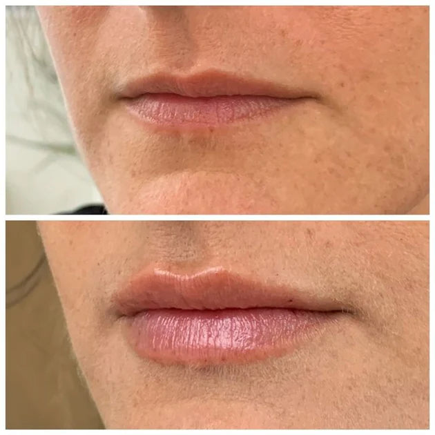 Beauty Kit for Fyldigere Lepper og Lengre Vipper